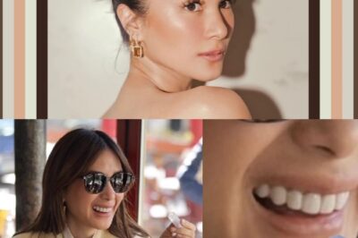 OMG! HEART EVANGELISTA iSKAMER DAW, SABI NG ISANG FOREIGNER NA DENTAL HYGIENIST! PANOORIN ANG MGA DETALYE, APEKTADO ANG CAREER NI HEART!